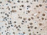 Centrin 2 Antibody in Immunohistochemistry (Paraffin) (IHC (P))