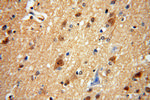 Centrin 2 Antibody in Immunohistochemistry (Paraffin) (IHC (P))