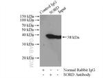 Sorbitol dehydrogenase Antibody in Immunoprecipitation (IP)