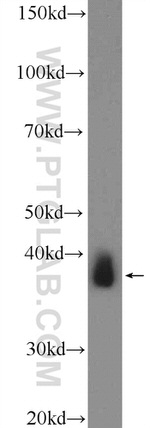 Sorbitol dehydrogenase Antibody in Western Blot (WB)