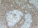 PPP2R1A Antibody in Immunohistochemistry (Paraffin) (IHC (P))