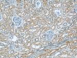 PPP2R1A Antibody in Immunohistochemistry (Paraffin) (IHC (P))