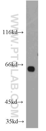 PPP2R1A Antibody in Western Blot (WB)