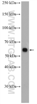 PPP2R1A Antibody in Western Blot (WB)