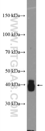 CKM/CKB Antibody in Western Blot (WB)