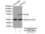 BTN3A3 Antibody in Immunoprecipitation (IP)