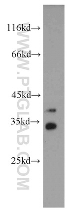 NECAP2 Antibody in Western Blot (WB)