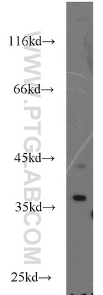 NECAP2 Antibody in Western Blot (WB)