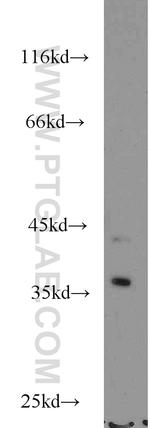 NECAP2 Antibody in Western Blot (WB)