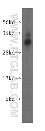 NECAP2 Antibody in Western Blot (WB)