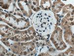 ACTO9 Antibody in Immunohistochemistry (Paraffin) (IHC (P))