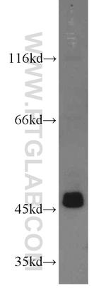 ACTO9 Antibody in Western Blot (WB)