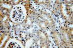 ACTO9 Antibody in Immunohistochemistry (Paraffin) (IHC (P))