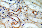 ACTO9 Antibody in Immunohistochemistry (Paraffin) (IHC (P))