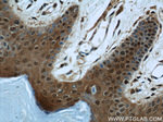 GSTP1 Antibody in Immunohistochemistry (Paraffin) (IHC (P))