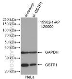 GSTP1 Antibody in Western Blot (WB)