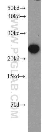 GSTP1 Antibody in Western Blot (WB)