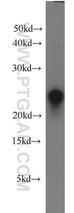 GSTP1 Antibody in Western Blot (WB)