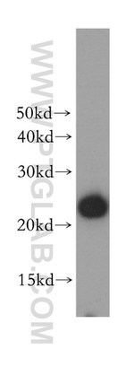 GSTP1 Antibody in Western Blot (WB)