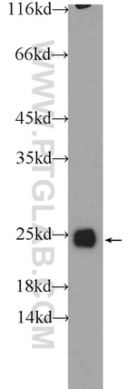 GSTP1 Antibody in Western Blot (WB)