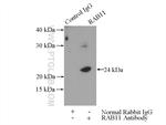 RAB11A/B Antibody in Immunoprecipitation (IP)