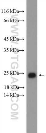 RAB11A/B Antibody in Western Blot (WB)