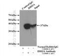 IDH3A Antibody in Immunoprecipitation (IP)