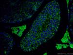 ALDH1A1 Antibody in Immunohistochemistry (PFA fixed) (IHC (PFA))