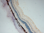 ALDH1A1 Antibody in Immunohistochemistry (Paraffin) (IHC (P))