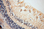 ALDH1A1 Antibody in Immunohistochemistry (Paraffin) (IHC (P))