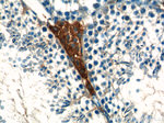 ALDH1A1 Antibody in Immunohistochemistry (Paraffin) (IHC (P))