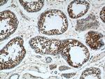 ALDH1A1 Antibody in Immunohistochemistry (Paraffin) (IHC (P))