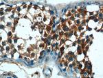 ALDH1A1 Antibody in Immunohistochemistry (Paraffin) (IHC (P))