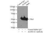 ALDH1A1 Antibody in Immunoprecipitation (IP)