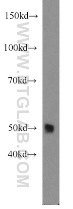 ALDH1A1 Antibody in Western Blot (WB)