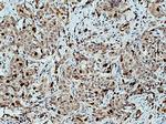 KIF20A Antibody in Immunohistochemistry (Paraffin) (IHC (P))