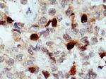 KIF20A Antibody in Immunohistochemistry (Paraffin) (IHC (P))