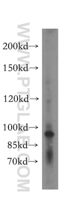 KIF20A Antibody in Western Blot (WB)