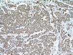 UBE1 Antibody in Immunohistochemistry (Paraffin) (IHC (P))