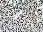 UBE1 Antibody in Immunohistochemistry (Paraffin) (IHC (P))