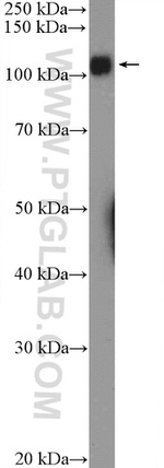 UBE1 Antibody in Western Blot (WB)