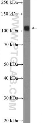 UBE1 Antibody in Western Blot (WB)