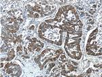 CTP synthase Antibody in Immunohistochemistry (Paraffin) (IHC (P))