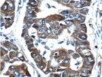 CTP synthase Antibody in Immunohistochemistry (Paraffin) (IHC (P))