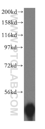 TBCC Antibody in Western Blot (WB)