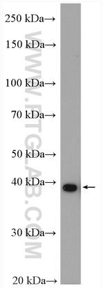 TBCC Antibody in Western Blot (WB)