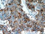 AMACR/p504S Antibody in Immunohistochemistry (Paraffin) (IHC (P))