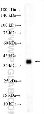 AMACR/p504S Antibody in Western Blot (WB)