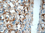 AMACR/p504S Antibody in Immunohistochemistry (Paraffin) (IHC (P))