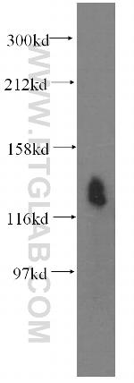 SLC12A4 Antibody in Western Blot (WB)